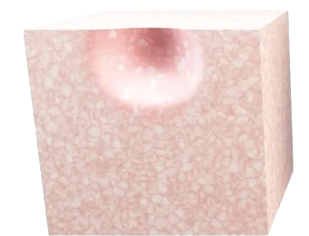 1Prima_della_Terapia